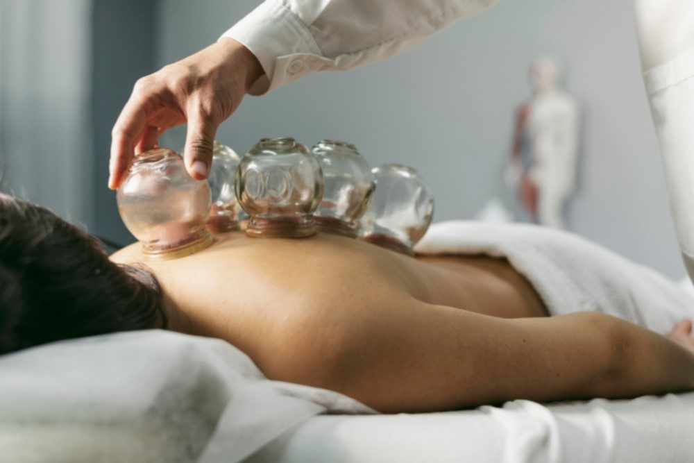 kinesist antwerpen cupping